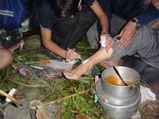 飽餐的ㄍㄚˇ ㄍㄨ（水蛭）....在傷口上灑鹽